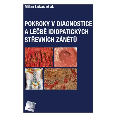 Pokroky v diagnostice a léčbě idiopatických střevních zánětů