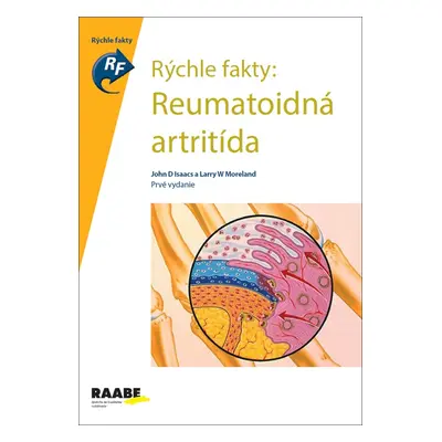 Rýchle fakty: Reumatoidná artritída