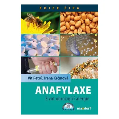 Anafylaxe