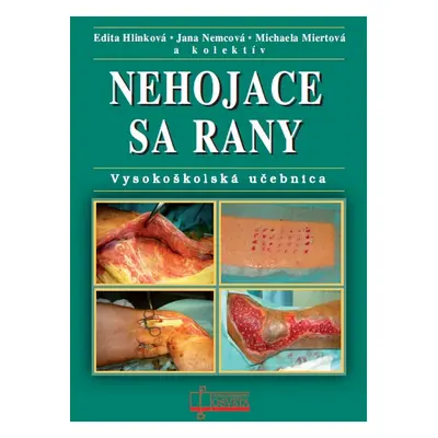 Nehojace sa rany