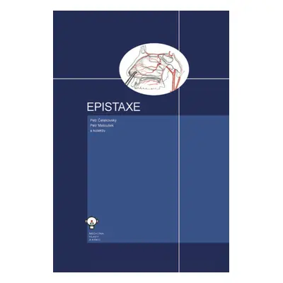 Epistaxe