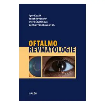 Oftalmorevmatologie