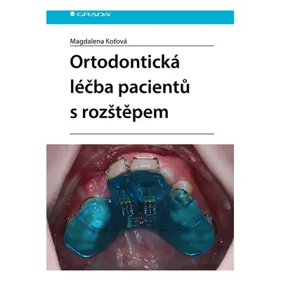 Ortodontická léčba pacientů s rozštěpem