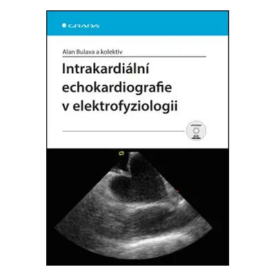 Intrakardiální echokardiografie v elektrofyziologii