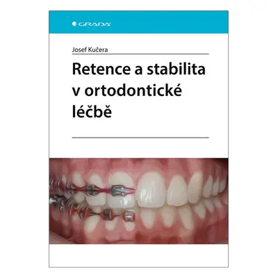 Retence a stabilita v ortodontické léčbě