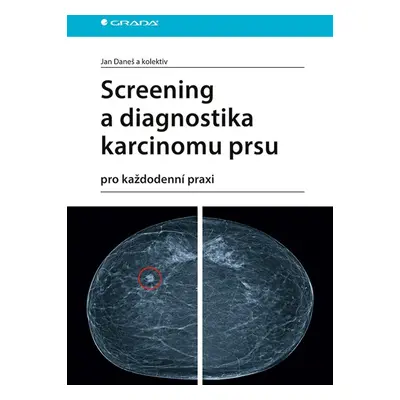 Screening a diagnostika karcinomu prsu