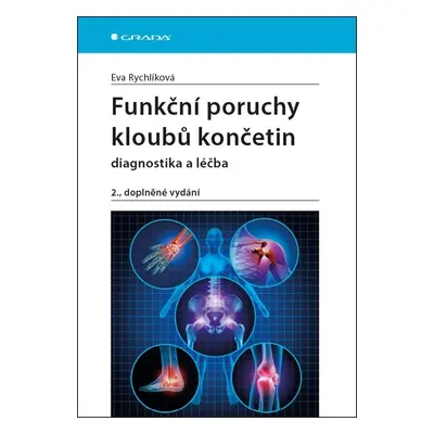 Funkční poruchy kloubů končetin