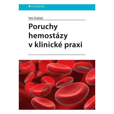 Poruchy hemostázy v klinické praxi