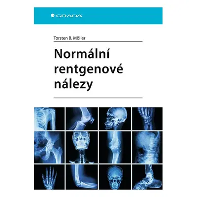 Normální rentgenové nálezy