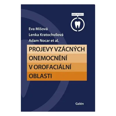 Projevy vzácných onemocnění v orofaciální oblasti