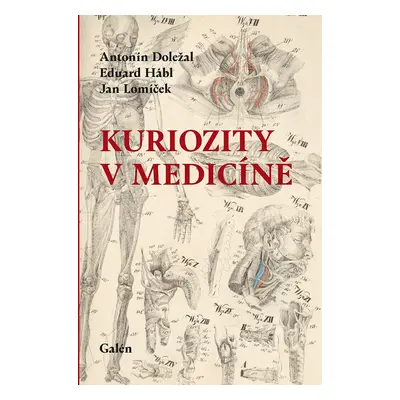 Kuriozity v medicíně