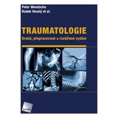 Traumatologie