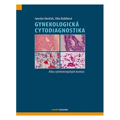 Gynekologická cytodiagnostika