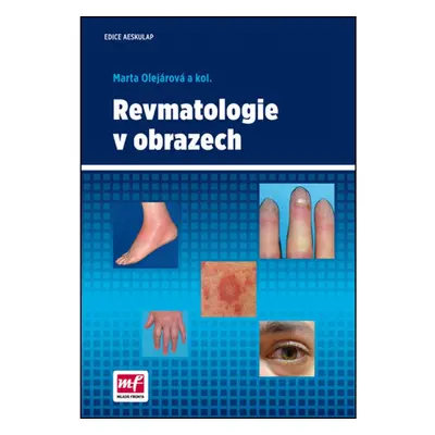 Revmatologie v obrazech