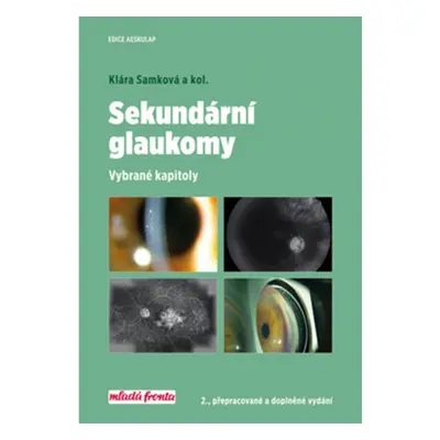 Sekundární glaukomy