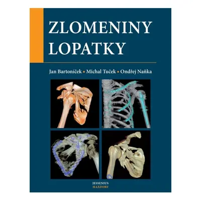 Zlomeniny lopatky Maxdorf s.r.o.