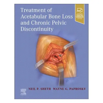 Treatment of Acetabular Bone Loss and Chronic Pelvic Discontinuity Elsevier