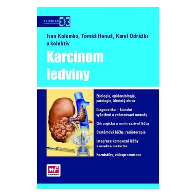 Karcinom ledviny Mladá fronta