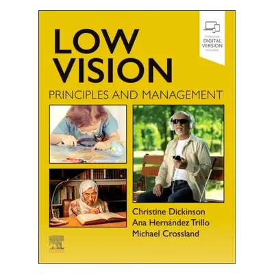 Low Vision, Principles and Management Elsevier