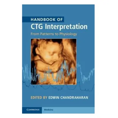 Handbook of CTG Interpretation, From Patterns to Physiology Cambridge University Press