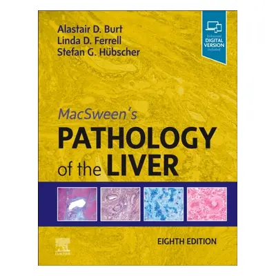 MacSween´s Pathology of the Liver, 8th Edition Elsevier