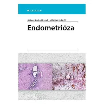 Endometrióza GRADA Publishing, a. s.