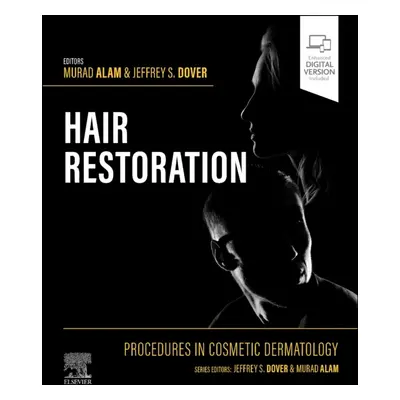 Procedures in Cosmetic Dermatology: Hair Restoration Elsevier