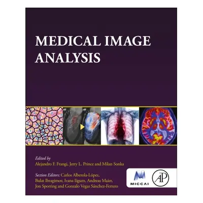 Medical Image Analysis Elsevier