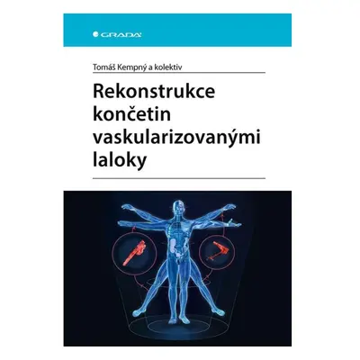 Rekonstrukce končetin vaskularizovanými laloky GRADA Publishing, a. s.