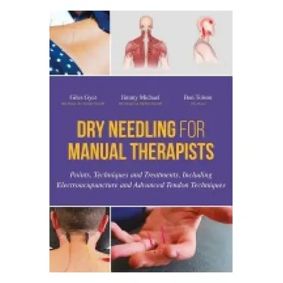 Dry Needling for Manual Therapists, Points, Techniques and Treatments, Including Electroacupunct