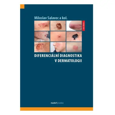 Diferenciální diagnostika v dermatologii Maxdorf s.r.o.