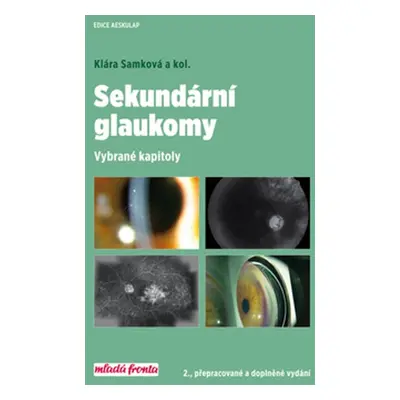 Sekundární glaukomy - Vybrané kapitoly (Klára Samková)