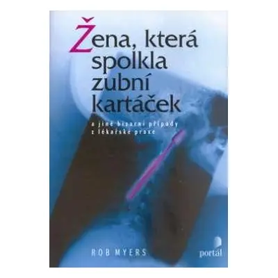 Žena, která spolkla zubní kartáček (Bob Myers)