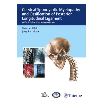 "Cervical Spondylotic Myelopathy and Ossification of Posterior Longitudinal Ligament: Wfns Spine