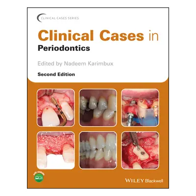 "Clinical Cases in Periodontics" - "" ("Karimbux Nadeem")(Paperback)