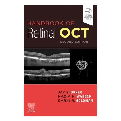 "Handbook of Retinal Oct: Optical Coherence Tomography" - "" ("Duker Jay S.")(Paperback)