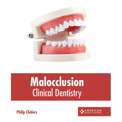 "Malocclusion: Clinical Dentistry" - "" ("Chiders Philip")(Pevná vazba)