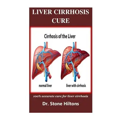 "Liver Cirrhosis Cure: 100% accurate cure for liver cirrhosis" - "" ("Hiltons Stone")(Paperback)