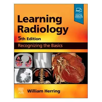 "Learning Radiology: Recognizing the Basics" - "" ("Herring William")(Paperback)