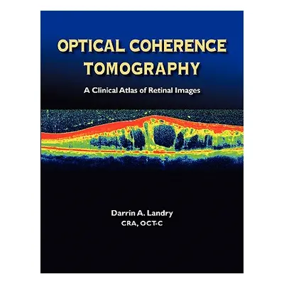 "Optical Coherence Tomography a Clinical Atlas of Retinal Images" - "" ("Landry Darrin A.")(Pape