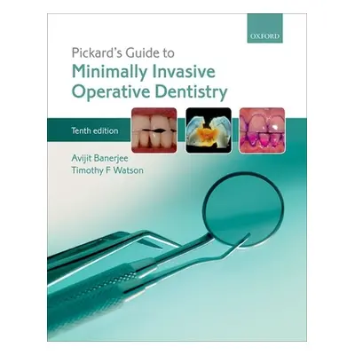 "Pickard's Guide to Minimally Invasive Operative Dentistry" - "" ("Banerjee Avit")(Paperback)