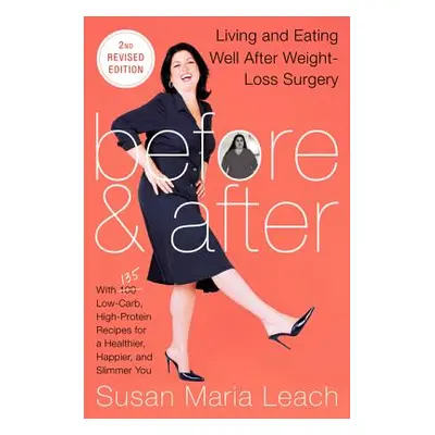 "Before & After 2nd REV Ed PB" - "" ("Leach Susan Maria")(Paperback)