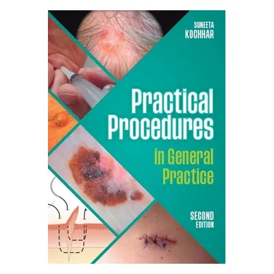 "Practical Procedures in General Practice, second edition" - "" ("Kochhar Suneeta (GP in East Su