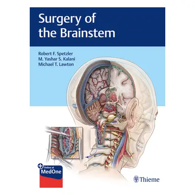 "Surgery of the Brainstem" - "" ("Spetzler Robert F.")(Pevná vazba)