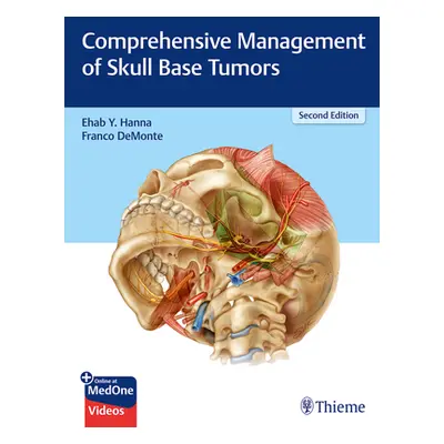 "Comprehensive Management of Skull Base Tumors" - "" ("Hanna Ehab Y.")(Pevná vazba)