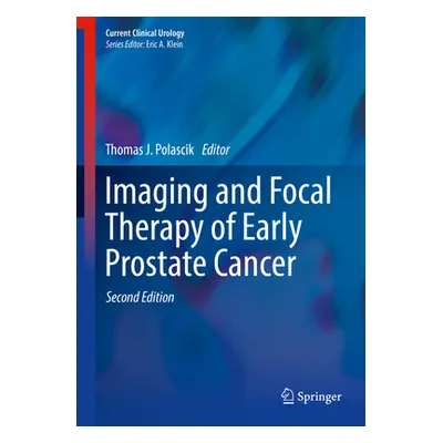 "Imaging and Focal Therapy of Early Prostate Cancer" - "" ("Polascik Thomas J.")(Pevná vazba)