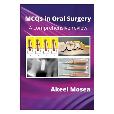 "MCQs in Oral Surgery: A comprehensive review" - "" ("Mosea Akeel")(Paperback)