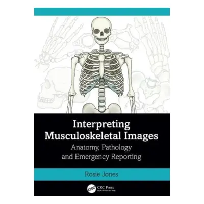 "Interpreting Musculoskeletal Images: Anatomy, Pathology and Emergency Reporting" - "" ("Jones R