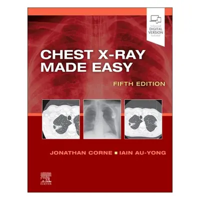 "Chest X-Ray Made Easy" - "" ("Corne Jonathan")(Paperback)