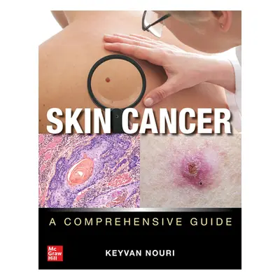 "Skin Cancer: A Comprehensive Guide" - "" ("Nouri Keyvan")(Pevná vazba)